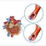 Mediterranean Diet for heart